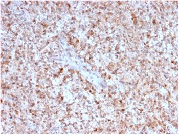 Anti-CD40 Ligand / CD154 / TRAP1 (Activation Marker of T-Lymphocytes) Monoclonal Antibody(Clone: CD40LG/2763)