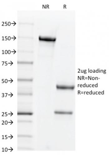 Anti-CD44v3 (Marker of Tumor Metastasis) Monoclonal Antibody(Clone: 2F10)