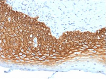 Anti-CD44v3 (Marker of Tumor Metastasis) Monoclonal Antibody(Clone: 3G5)