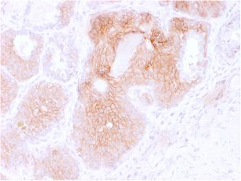 Anti-CD44v6 (Marker of Tumor Metastasis) Monoclonal Antibody(Clone: CD44V6/2496)