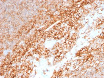 Anti-CD44 / HCAM Std. Monoclonal Antibody(Clone: BU75)