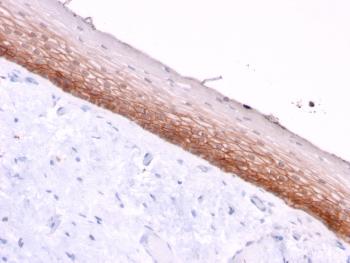 Anti-CD44v4/5 (Marker of Tumor Metastasis) Monoclonal Antibody(Clone: 3D2)