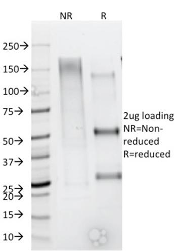 Anti-CD44 / HCAM Std. (Cancer Stem Cell Marker) Monoclonal Antibody(Clone: rHCAM/918)