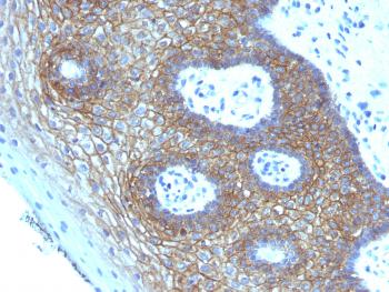 Anti-CD44v4 (Marker of Tumor Metastasis) Monoclonal Antibody(Clone: CD44v4/1219)