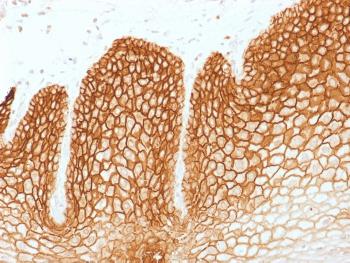 Anti-CD44v6 (Marker of Tumor Metastasis) Monoclonal Antibody(Clone: CD44v6/1246)