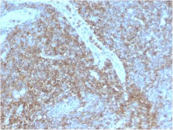 Anti-CD44 / HCAM Std. Monoclonal Antibody(Clone: HCAM/2875R)