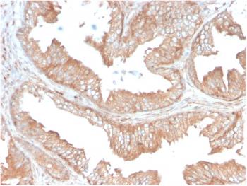 Anti-CD47 / IAP (Integrin Associated Protein) Monoclonal Antibody(Clone: CD47/3019)