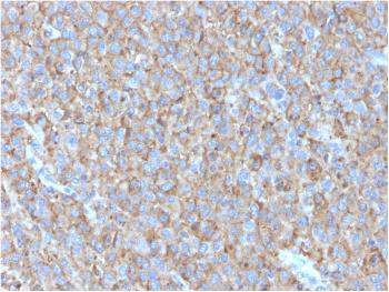 Anti-CD63 (Late Endosomes Marker) Monoclonal Antibody(Clone: LAMP3/2790)