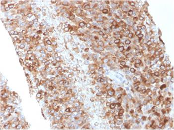 Anti-CD63 (Late Endosomes Marker) Monoclonal Antibody(Clone: LAMP3/2881)