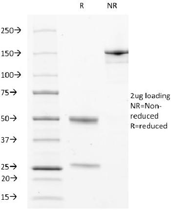 Anti-CD63 (Late Endosomes Marker) Monoclonal Antibody(Clone: LAMP3/529)