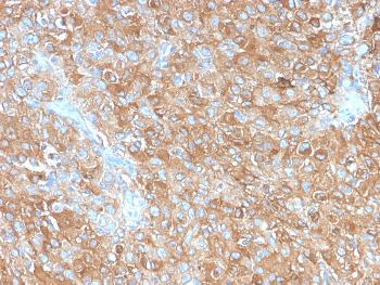 Anti-CD63 (Late Endosomes Marker) Monoclonal Antibody(Clone: LAMP3/2990R)