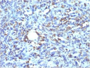 Anti-CD68 (Macrophage Marker) Monoclonal Antibody(Clone: rLAMP4/824)