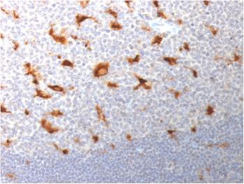 Anti-CD68 (Macrophage Marker) Monoclonal Antibody(Clone: LAMP4/1830)