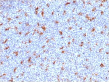 Anti-CD68 (Macrophage Marker) Monoclonal Antibody(Clone: C68/2501)