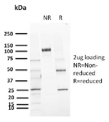 Anti-CD72 (B Cell Marker) Monoclonal Antibody(Clone: BU40)