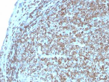 Anti-CD74 (B-Cell Marker) Monoclonal Antibody(Clone: CLIP/3127R)