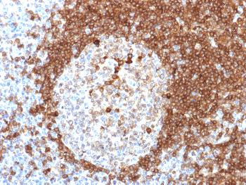 Anti-CD79a (B-Cell Marker) Monoclonal Antibody(Clone: HM57)