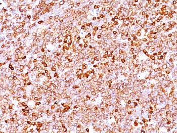 Anti-CD79a (B-Cell Marker) Monoclonal Antibody(Clone: IGA/1688R)