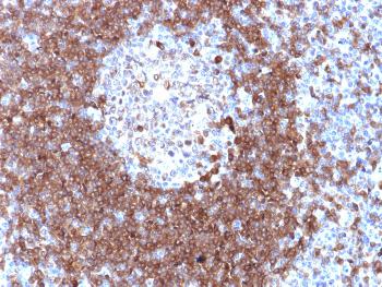 Anti-CD79a (B-Cell Marker) Polyclonal Antibody