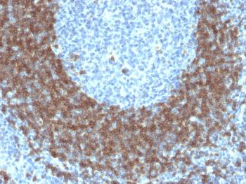 Anti-CD79b (B-Cell Marker) Monoclonal Antibody(Clone: IGB/1842)