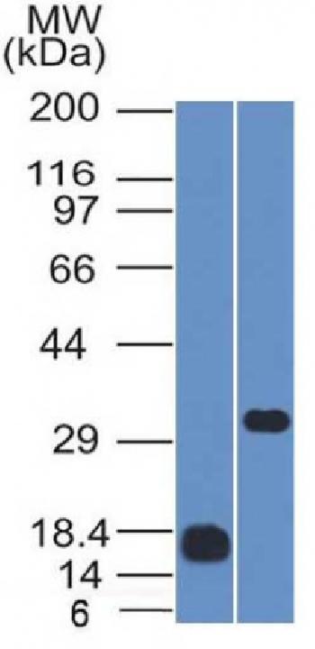 Anti-CD79b (B-Cell Marker) Monoclonal Antibody(Clone: IGB/1843)