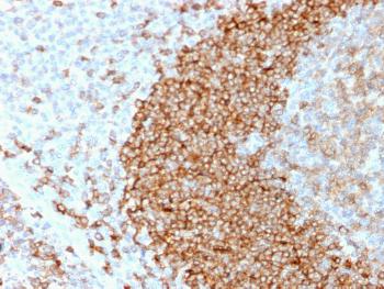 Anti-CD79b (B-Cell Marker) Monoclonal Antibody(Clone: B29/123)