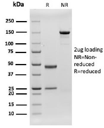 Anti-CD79b (B-Cell Marker) Monoclonal Antibody(Clone: rIGB/1842)