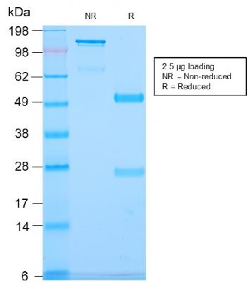 Anti-CD79b (B-Cell Marker) Monoclonal Antibody(Clone: IGB/2940R)