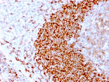 Anti-CD79b (B-Cell Marker) Monoclonal Antibody(Clone: IGB/3170R)