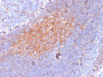 Anti-CD81 / TAPA-1 Monoclonal Antibody(Clone: 1.3.3.22)