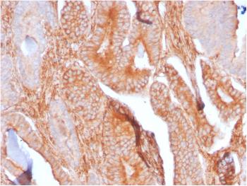 Anti-CD81 / TAPA-1 Monoclonal Antibody(Clone: C81/2885R)