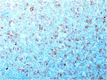 Anti-Cdk1 / p34cdc2 Monoclonal Antibody(Clone: CDK1/873)