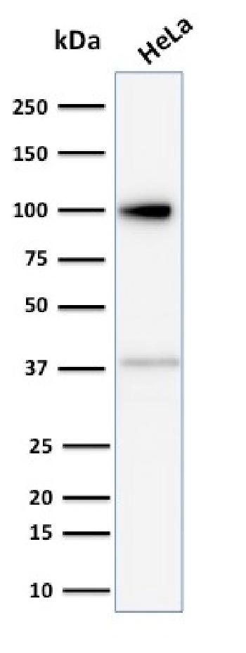 Anti-Major Vault Protein (MVP) Monoclonal Antibody(Clone: 1014)