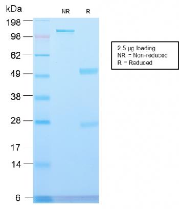 Anti-Major Vault Protein (MVP) Monoclonal Antibody(Clone: VP2897R)