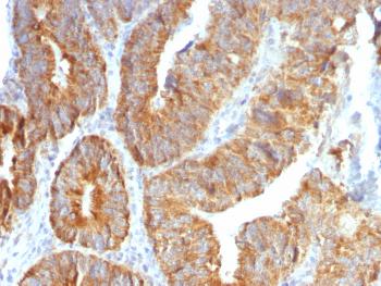 Anti-TNFS15 / VEGI (Vascular Endothelial Growth Inhibitor) Monoclonal Antibody(Clone: VEGI/1283)