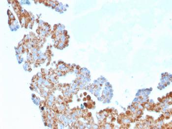 Anti-Cell Division Cycle 34 homolog Monoclonal Antibody(Clone: CPTC-CDC34-2)