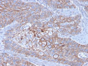 Anti-E-Cadherin (CDH1) / CD324 (Intercellular Junction Marker) Monoclonal Antibody(Clone: CDH1/3256)