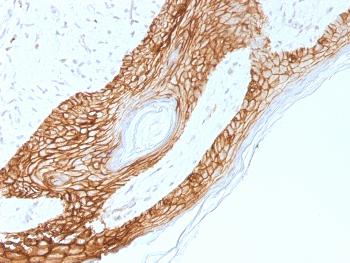 Anti-E-Cadherin (CDH1) / CD324 (Intercellular Junction Marker) Monoclonal Antibody(Clone: 4A2)