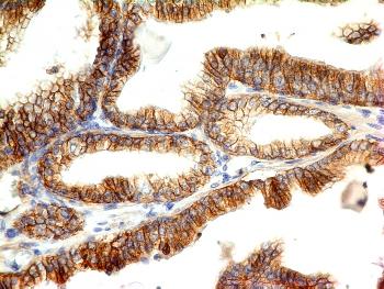 Anti-E-Cadherin (CDH1) / CD324 (Intercellular Junction Marker) Monoclonal Antibody(Clone: CDH1/1525)