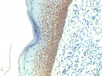 Anti-E-Cadherin / CD324 (Intercellular Junction Marker) Monoclonal Antibody(Clone: SPM381)