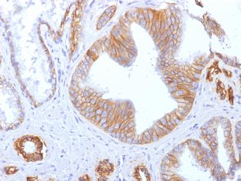 Anti-E-Cadherin / CD324 (Intercellular Junction Marker) Monoclonal Antibody(Clone: SPM471)