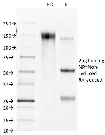 Anti-Connexin 32 (Gap Junction Protein) Monoclonal Antibody(Clone: R5.21C)