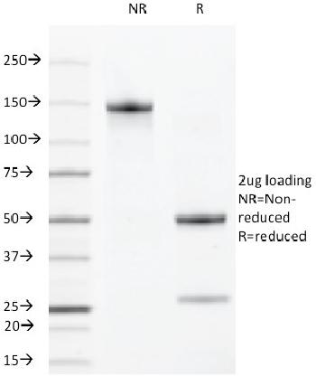 Anti-VEGF-R2 / CD309 / Flk-1 / KDR3 Monoclonal Antibody(Clone: DC101)