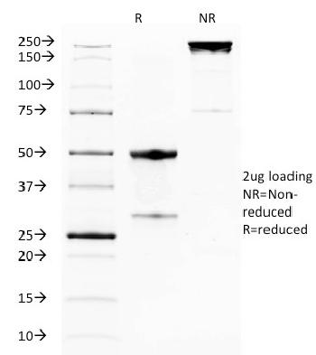 Anti-GITR / Tnfrsf18 (Mouse) Monoclonal Antibody(Clone: DTA-1)