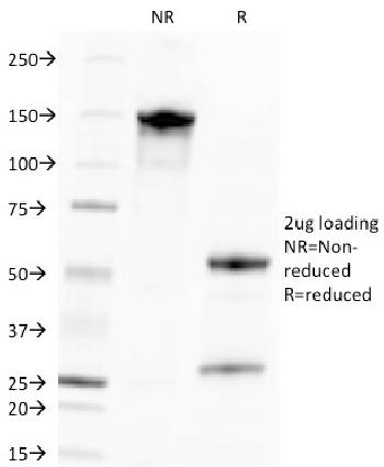 Anti-Cytomegalovirus p65 (CMV-p65) Monoclonal Antibody(Clone: CMV100)