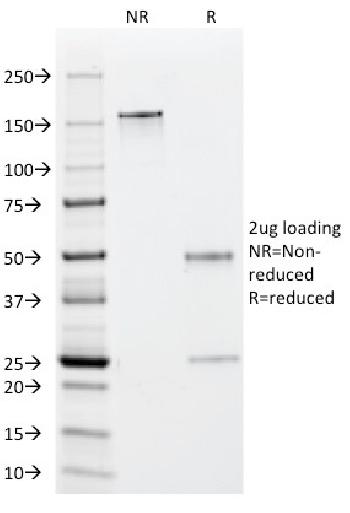 Anti-EBV Early Antigens (Epstein Barr Virus) Monoclonal Antibody(Clone: 1108-1)