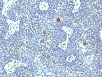 Anti-HPV-18 (Human Papilloma Virus 18) Monoclonal Antibody(Clone: HPV18/1297)