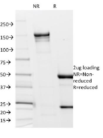 Anti-Borrelia burgdorferi (p41 Flagellin) Monoclonal Antibody(Clone: 6802)