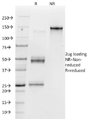 Anti-Vitronectin Receptor / CD51 / CD61 Monoclonal Antibody(Clone: 23C6)