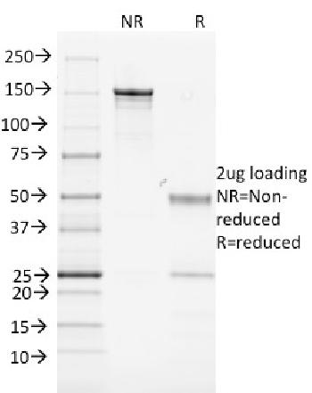 Anti-MHC II, Mouse Monoclonal Antibody(Clone: MK-D6)